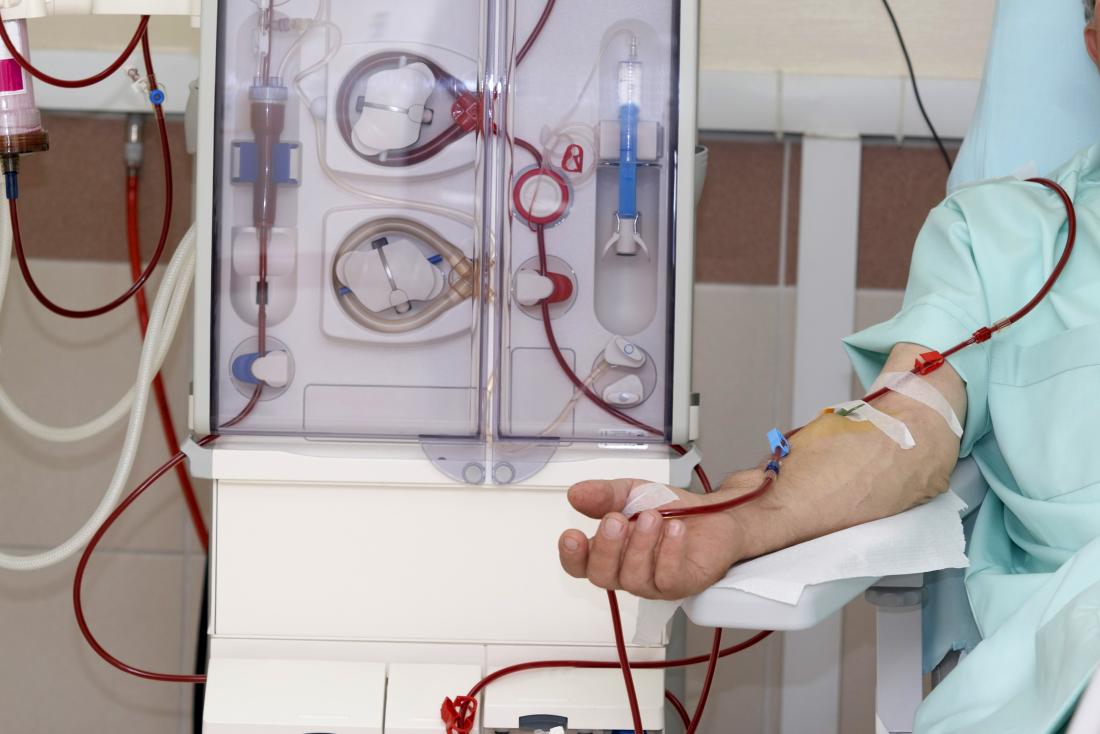 Know About Dialysis